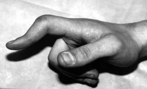 Pencil grip3